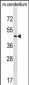 CHST2 Antibody (C-term)
